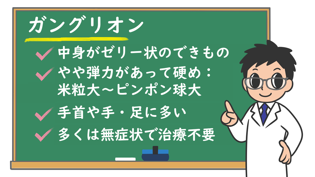 しこり 手首 の